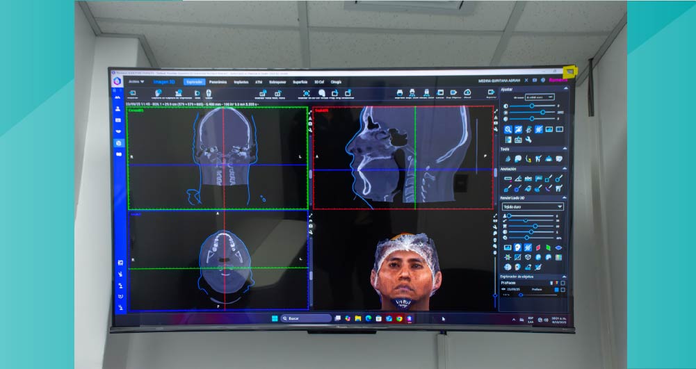 Slide image